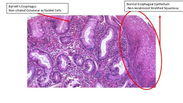 USMLE Step 1 Pathology review PART 2