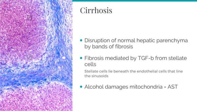USMLE Step 1 Pathology review PART 2