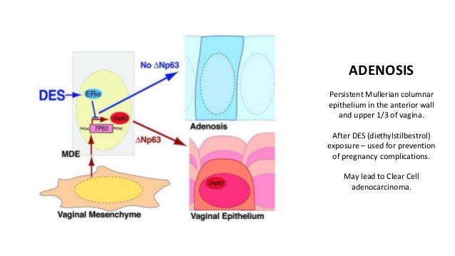 USMLE Step 1 Pathology review PART 2
