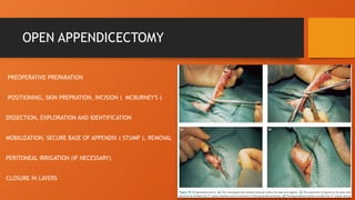 APPENDIX AND CONDITIONS RELATED TO IT.pptx