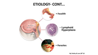 ETIOLOGY- CONT...
• Fecolith
• Lymphoid
Hyperplasia
• Parasites
Ref- Bailey & Love 28th Ed
 