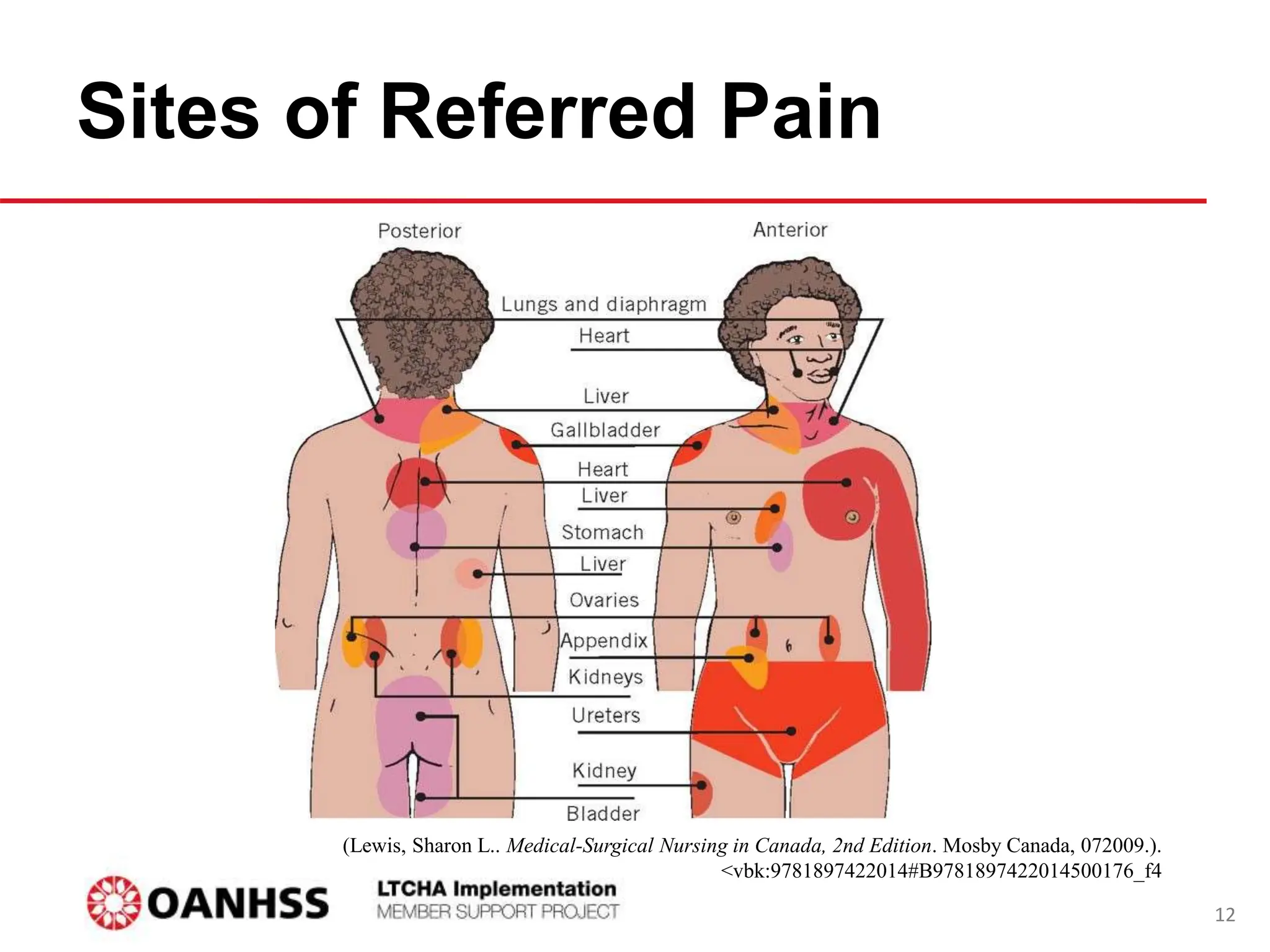 Sites of Referred Pain
(Lewis, Sharon L.. Medical-Surgical Nursing in Canada, 2nd Edition. Mosby Canada, 072009.).
<vbk:9781897422014#B9781897422014500176_f4
12
 