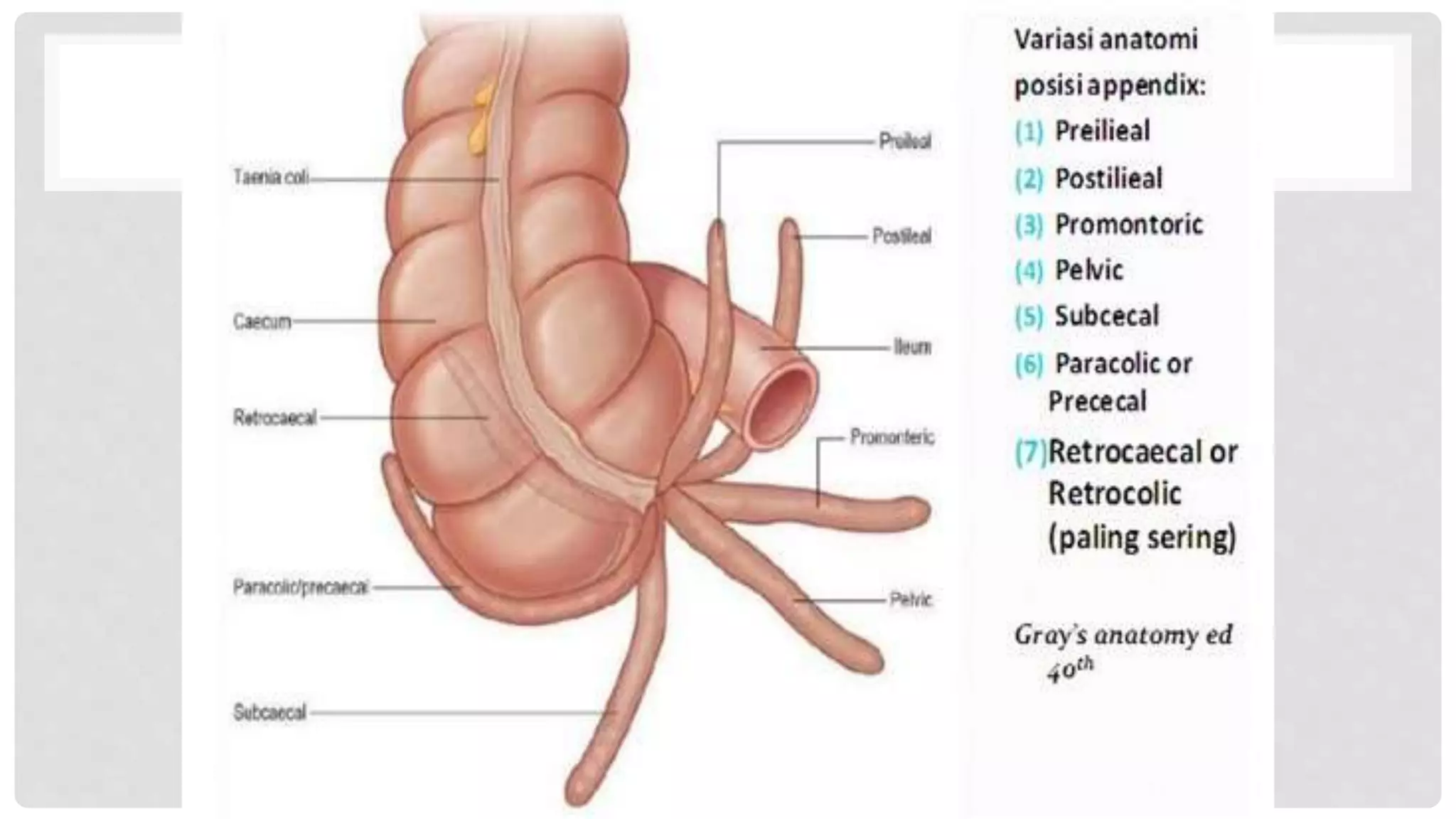 Anatomy of appendix | PPTX