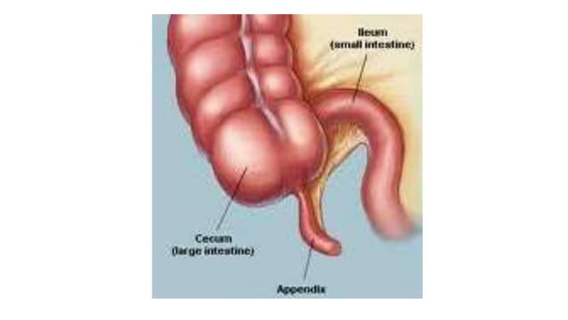 Perfed Appendix Anatomy of appendix | PPTX | Brain and Nervous System Disorders ...