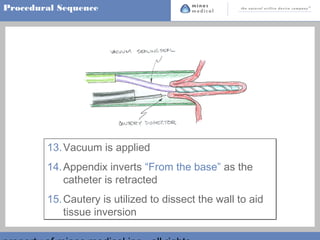 Appendoectomy | PPT | Surgery | Medical Health