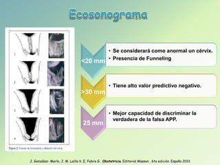 <20 mm
• Se considerará como anormal un cérvix.
• Presencia de Funneling
>30 mm
• Tiene alto valor predictivo negativo.
25 mm
• Mejor capacidad de discriminar la
verdadera de la falsa APP.
J. Gonzáles- Merlo, J. M. Lailla V, E. Fabre G. Obstetricia. Editorial Masson , 6ta edición. España 2013
 