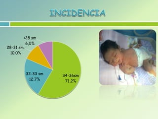 34-36sm
71,2%
32-33 sm
12,7%
28-31 sm.
10.0%
<28 sm
6,0%
 