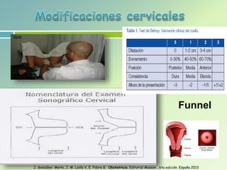 Funnel
J. Gonzáles- Merlo, J. M. Lailla V, E. Fabre G. Obstetricia. Editorial Masson , 6ta edición. España 2013
 