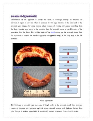 Inflammation of the appendix is usually the result of blockage causing an infection. The
appendix is open at one end where it connects to the large intestine. If the open end of the
appendix gets plugged for some reason, either because of swelling or because something from
the large intestine gets stuck in the opening, then the appendix starts to swell because of the
secretions from the lining. The swelling shuts off the blood supply and the appendix tissue dies.
An operation to remove the swollen appendix (an appendectomy) is the only way to fix this
problem.
Acute appendicitis
The blockage in appendix may also occur if lymph nodes in the appendix swell. Less common
causes of blockage are vegetable and fruit seeds, stomach worms, and thickened barium from
prior X-rays. In seniors, appendicitis is occasionally caused by a tumor (cancer) of the colon.
 