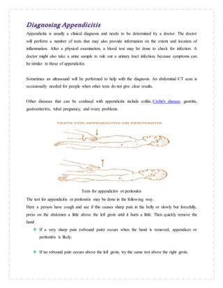 Appendicitis is usually a clinical diagnosis and needs to be determined by a doctor. The doctor
will perform a number of tests that may also provide information on the extent and location of
inflammation. After a physical examination, a blood test may be done to check for infection. A
doctor might also take a urine sample to rule out a urinary tract infection, because symptoms can
be similar to those of appendicitis.
Sometimes an ultrasound will be performed to help with the diagnosis. An abdominal CT scan is
occasionally needed for people when other tests do not give clear results.
Other diseases that can be confused with appendicitis include colitis, Crohn's disease, gastritis,
gastroenteritis, tubal pregnancy, and ovary problems.
Tests for appendicitis or peritonitis
The test for appendicitis or peritonitis may be done in the following way.
Here a person have cough and see if this causes sharp pain in the belly or slowly but forcefully,
press on the abdomen a little above the left groin until it hurts a little. Then quickly remove the
hand
 If a very sharp pain (rebound pain) occurs when the hand is removed, appendices or
peritonitis is likely.
 If no rebound pain occurs above the left groin, try the same test above the right groin.
 