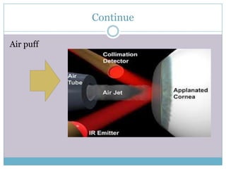 Puff Tonometry Tonometry | PPTX