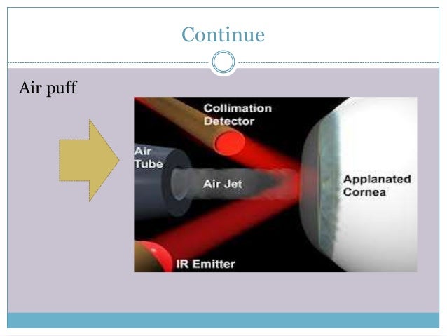Tonometry glaucoma diagram 