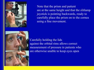 APPLANATION TONOMETRY (2) for Optometry .pptx