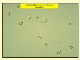 Conidia of Spilocaea pomi (Venturia
inaequalis)
 