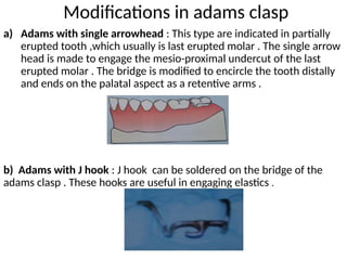 Adams Claps orthodontic appliances and its uses in brief | PPTX