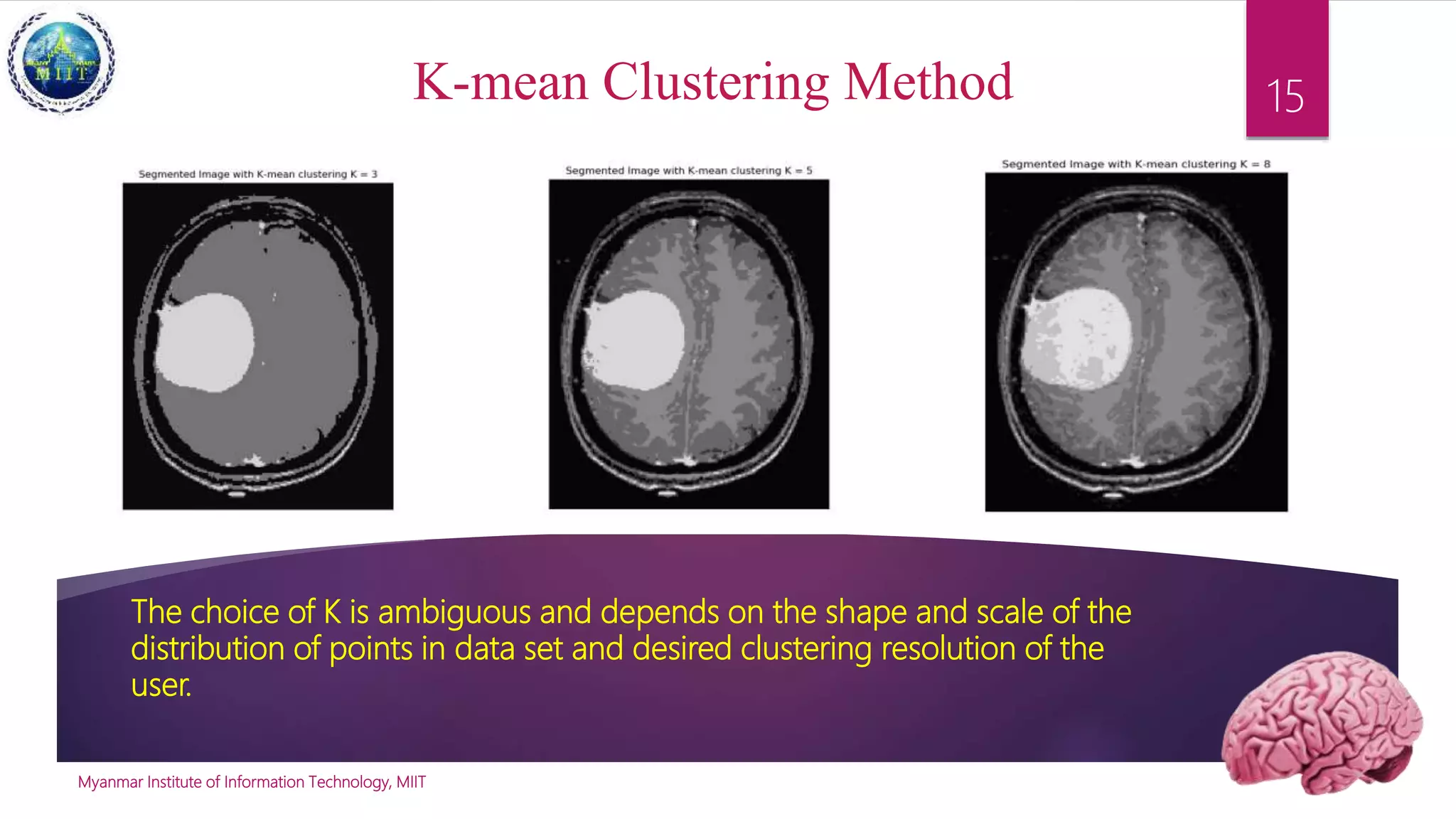 Application of-image-segmentation-in-brain-tumor-detection | PPTX ...