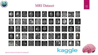 Myanmar Institute of Information Technology, MIIT
10MRI Dataset
 