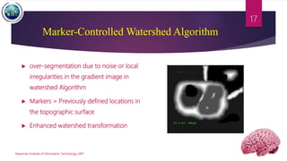 Marker-Controlled Watershed Algorithm
 over-segmentation due to noise or local
irregularities in the gradient image in
watershed Algorithm
 Markers = Previously defined locations in
the topographic surface
 Enhanced watershed transformation
Myanmar Institute of Information Technology, MIIT
17
 