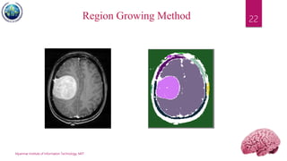 Myanmar Institute of Information Technology, MIIT
22Region Growing Method
 