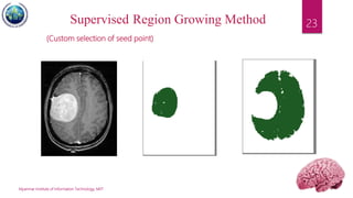 Myanmar Institute of Information Technology, MIIT
23Supervised Region Growing Method
(Custom selection of seed point)
 