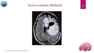 Myanmar Institute of Information Technology, MIIT
27Active-contour Methods
 