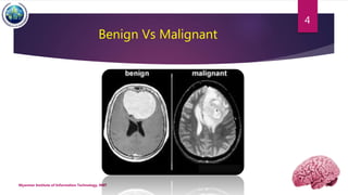 Benign Vs Malignant
Myanmar Institute of Information Technology, MIIT
4
 