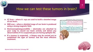 Application of-image-segmentation-in-brain-tumor-detection | PPTX ...