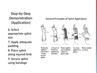 Comprehensive Guide to Application of Basic Splints in Orthopaedics | PPTX