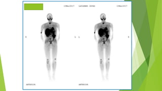Application of bone scan in primary bone tumors | PPTX