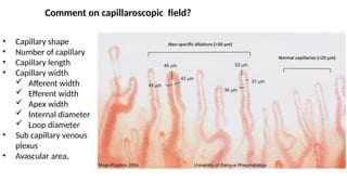 Application of Capillaroscope in daily practice.pptx