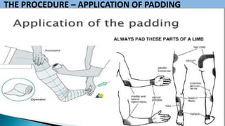 THE PROCEDURE – APPLICATION OF PADDING
 