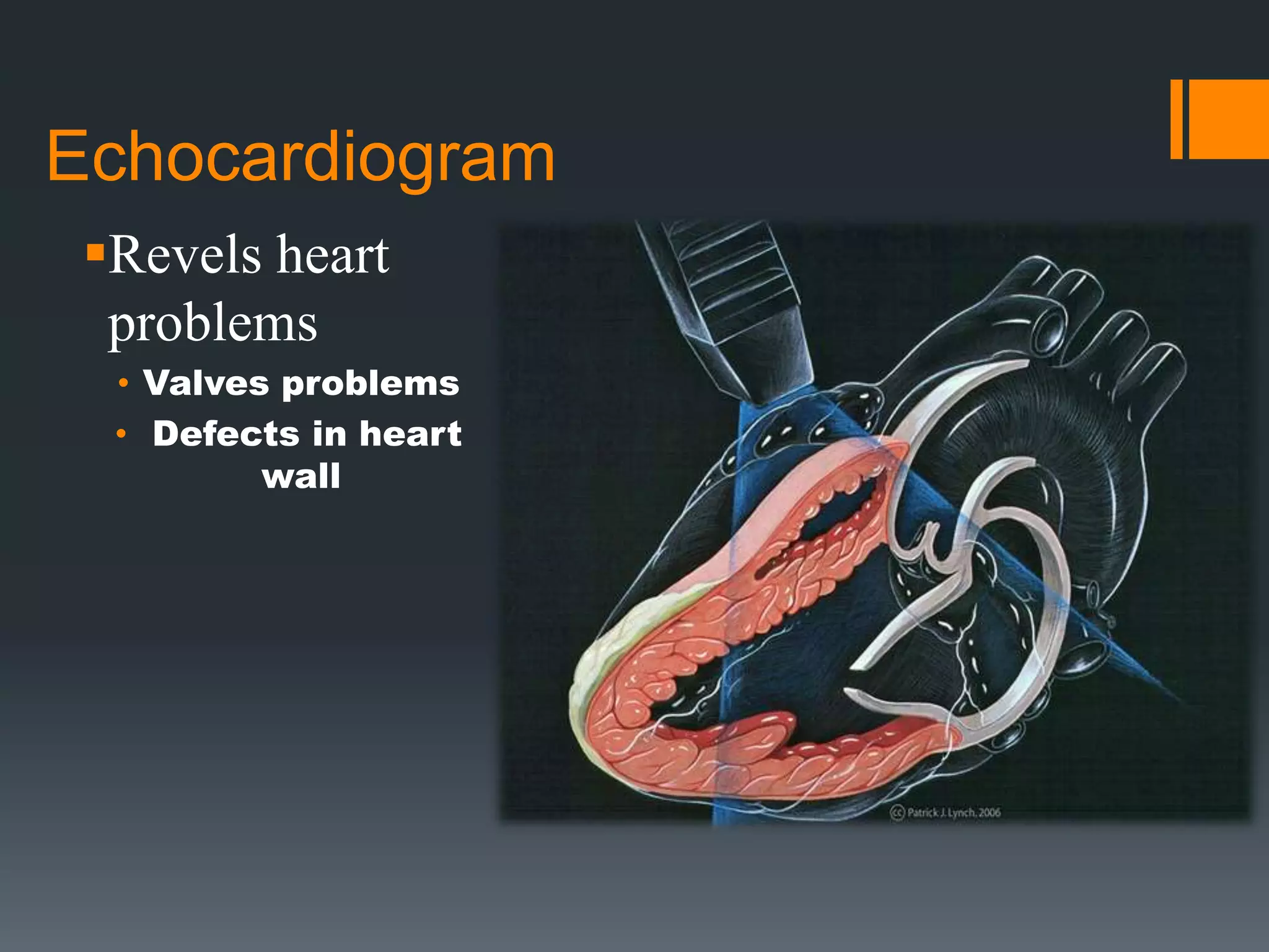 Echocardiogram
Revels heart
problems
• Valves problems
• Defects in heart
wall
 