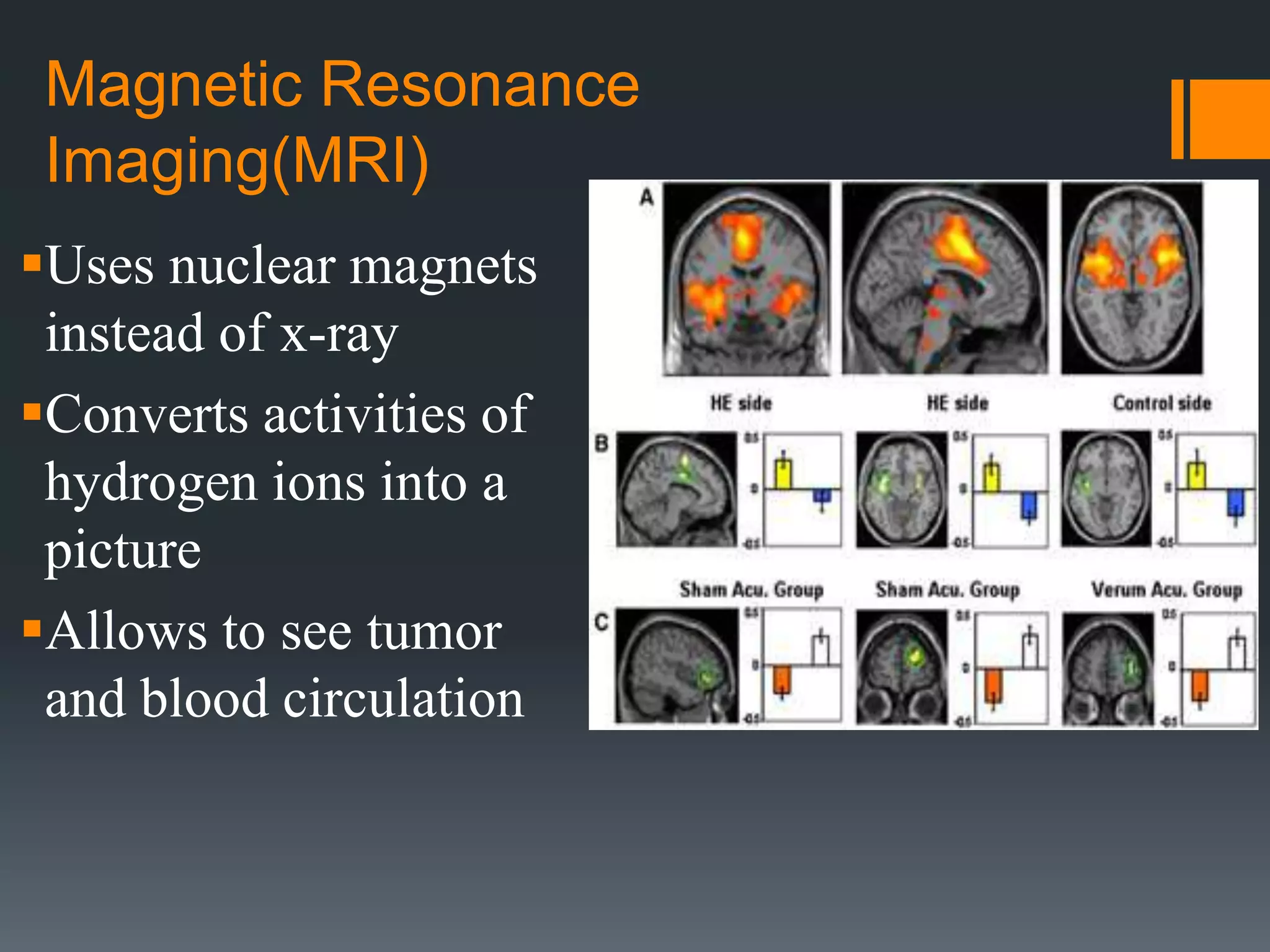 Magnetic Resonance
Imaging(MRI)
Uses nuclear magnets
instead of x-ray
Converts activities of
hydrogen ions into a
picture
Allows to see tumor
and blood circulation
 