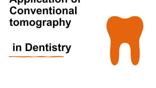 Application of
Conventional
tomography
in Dentistry
 
