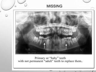 Application of opg in orthodontics | PPTX