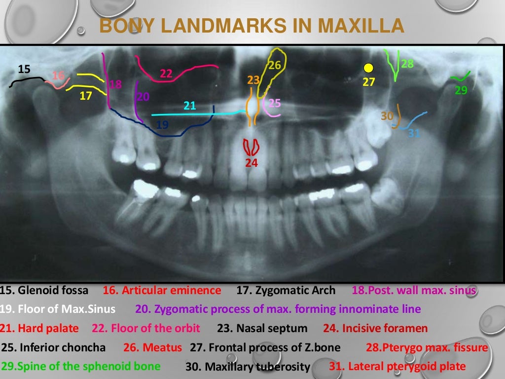 Application of opg in orthodontics