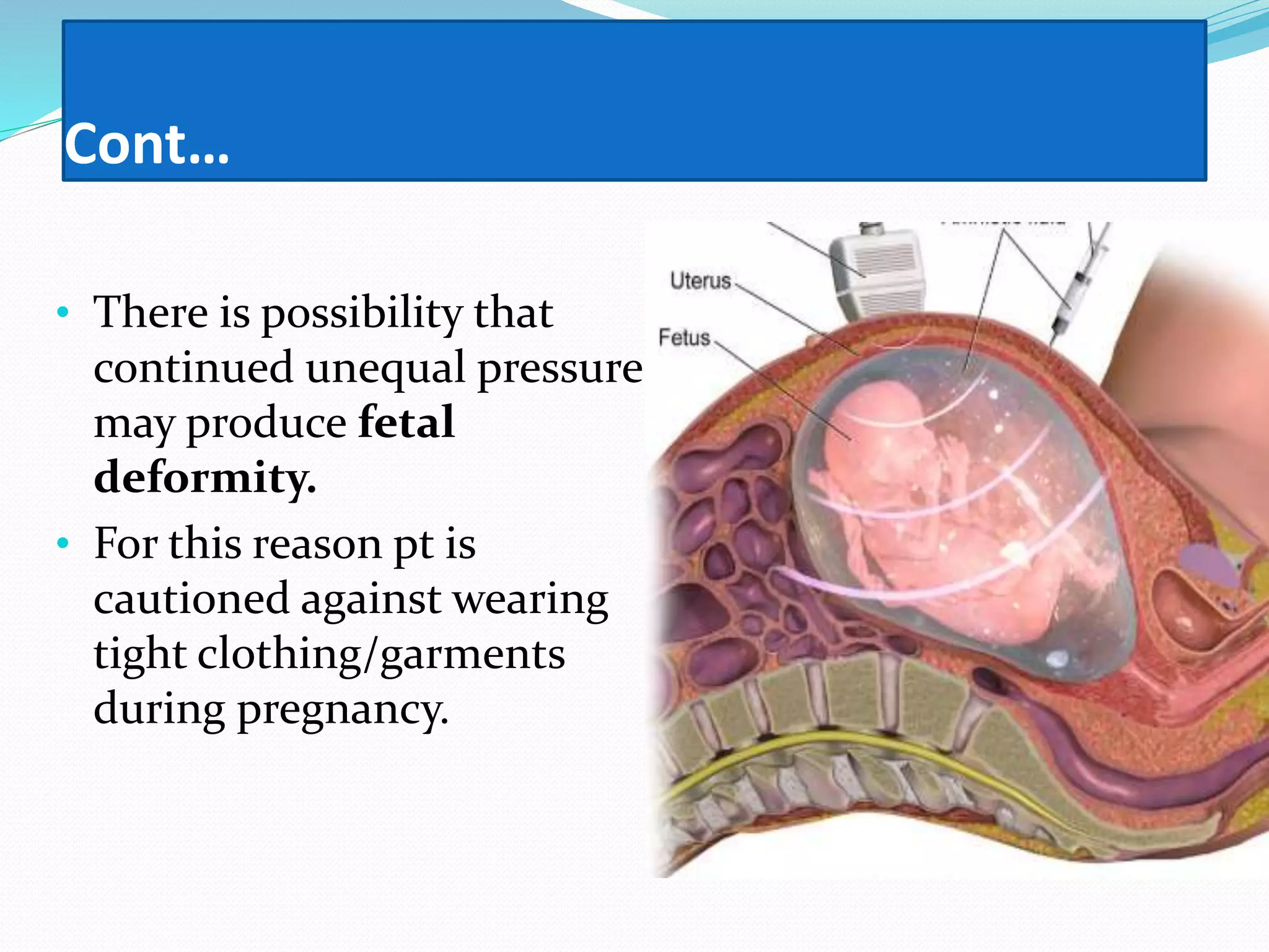 Cont…
• There is possibility that
continued unequal pressure
may produce fetal
deformity.
• For this reason pt is
cautioned against wearing
tight clothing/garments
during pregnancy.
 