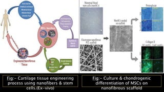 Application of Tissue engineering in Cartilage, Cardiac, Pancreas ...