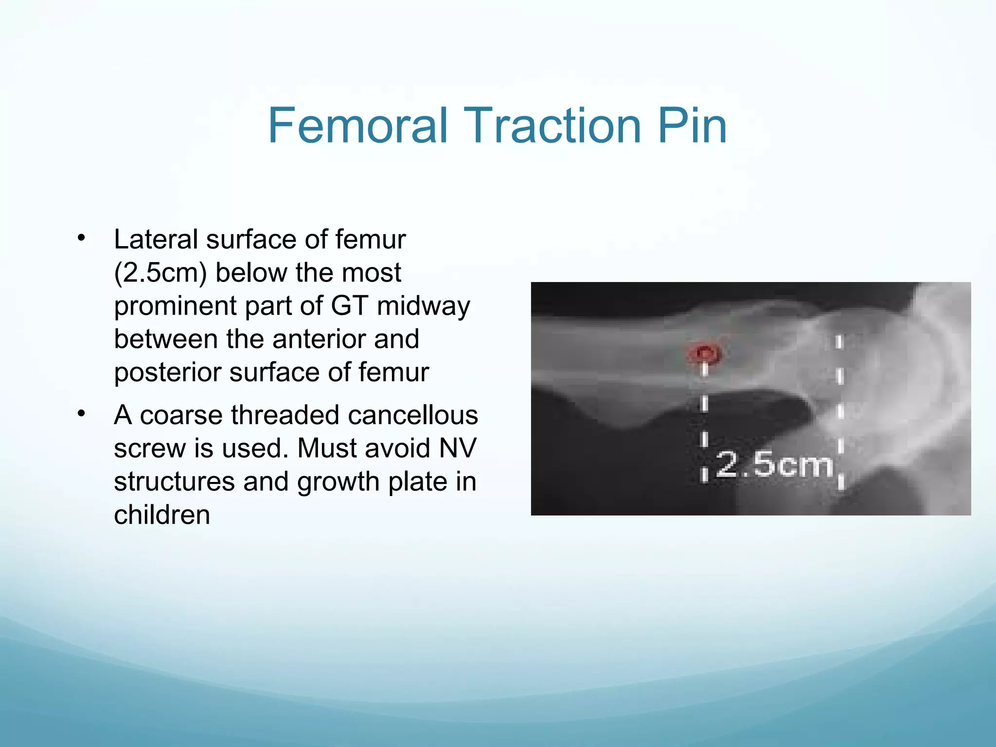 Traction Structures Patterns Application of traction in orthopaedics | PPT
