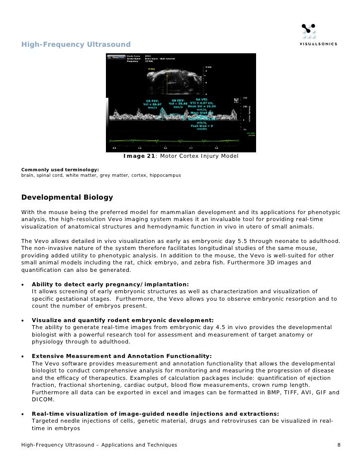 HighFrequency Ultrasound Application Features & Benefits