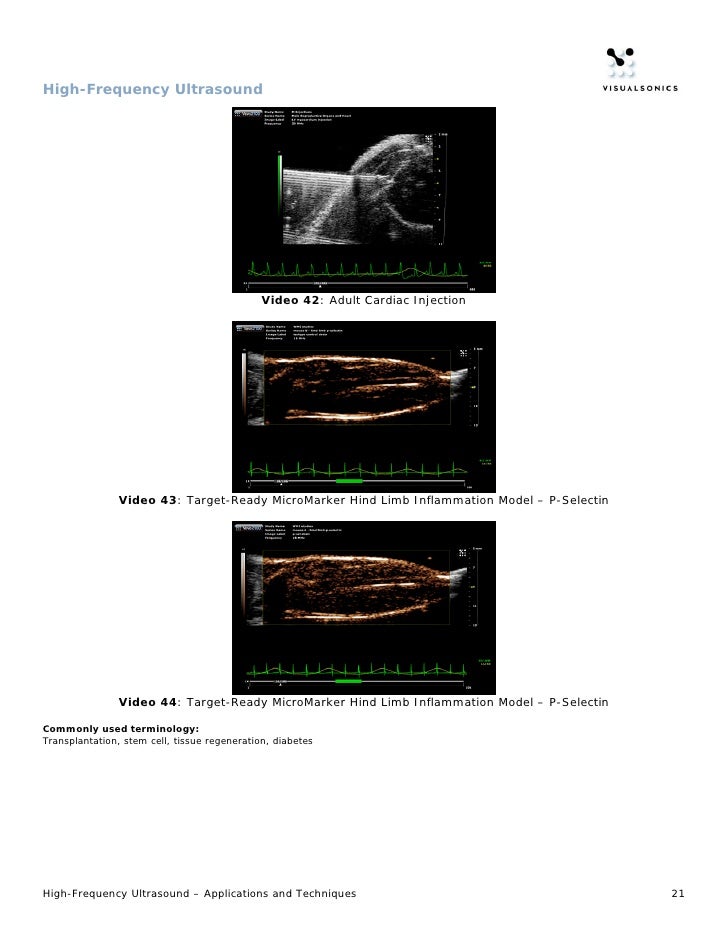 HighFrequency Ultrasound Application Features & Benefits