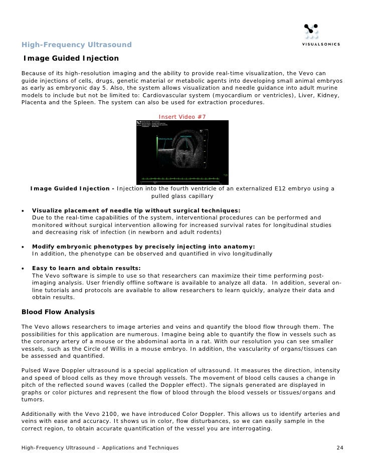 HighFrequency Ultrasound Application Features & Benefits