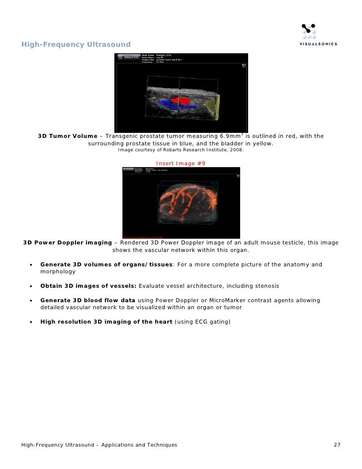 HighFrequency Ultrasound Application Features & Benefits