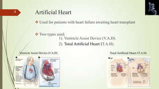 Artificial Heart 
 Used for patients with heart failure awaiting heart transplant 
 Two types used: 
1). Ventricle Assist Device (V.A.D). 
2). Total Artificial Heart (T.A.H). 
Ventricle Assist Device (V.A.D) Total Artificial Heart (T.A.H) 
4 
 