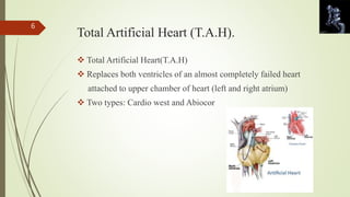 Total Artificial Heart (T.A.H). 
 Total Artificial Heart(T.A.H) 
 Replaces both ventricles of an almost completely failed heart 
attached to upper chamber of heart (left and right atrium) 
 Two types: Cardio west and Abiocor 
6 
 
