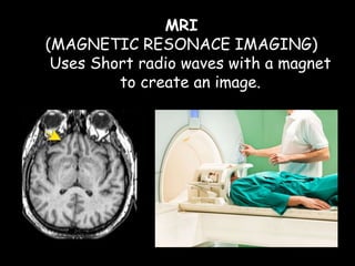 MRI
(MAGNETIC RESONACE IMAGING)
Uses Short radio waves with a magnet
to create an image.
 