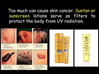 Too much can cause skin cancer. Suntan or
sunscreen lotions serve as filters to
protect the body from UV radiation.
 