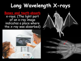 Bones and teeth absorb
x-rays. (The light part
of an x-ray image
indicates a place where
the x-ray was absorbed)
Long Wavelength X-rays
 