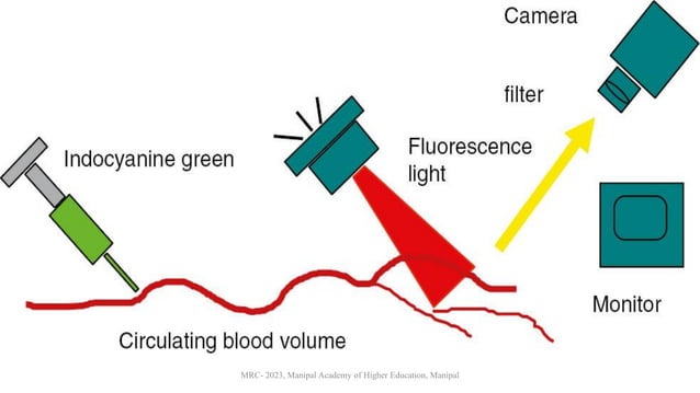 Applications of Indocyanine Green in Surgery.pdf