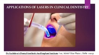 APPLICATIONS OF LASERS IN CLINICAL DENTISTRY
Dr. Sachdeva’s Dental Aesthetic And Implant Institute I 101, Ashok Vihar Phase 1, Delhi- 110052
 